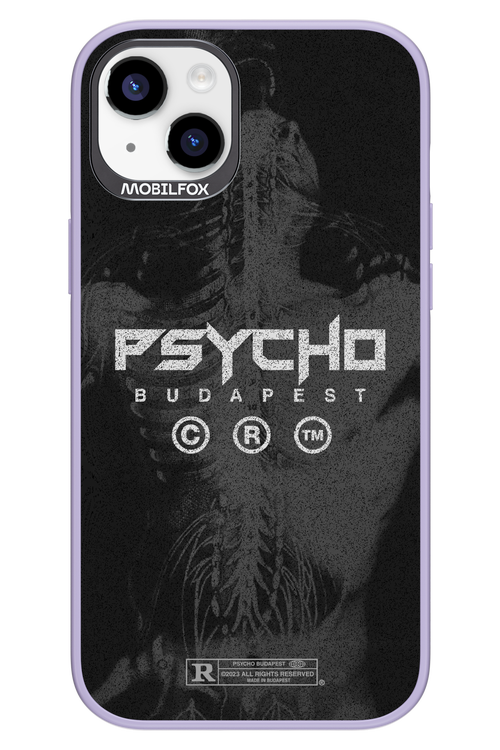 X-Ray - Apple iPhone 14 Plus