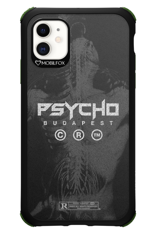 X-Ray - Apple iPhone 11