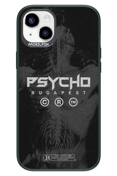 X-Ray - Apple iPhone 14 Plus