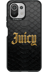 Juicy Gold 2.0 - Xiaomi Mi 11 Lite (2021)