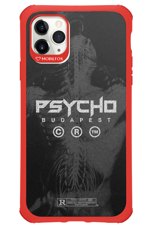 X-Ray - Apple iPhone 11 Pro Max