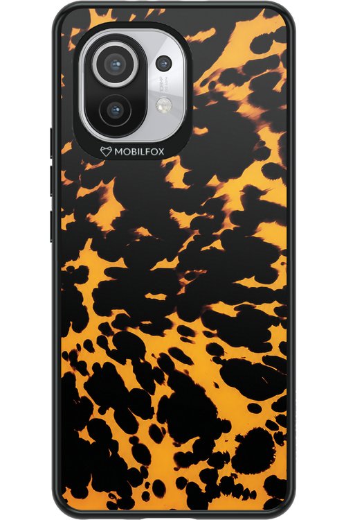 Tortoise Shell 2.0 - Xiaomi Mi 11 5G