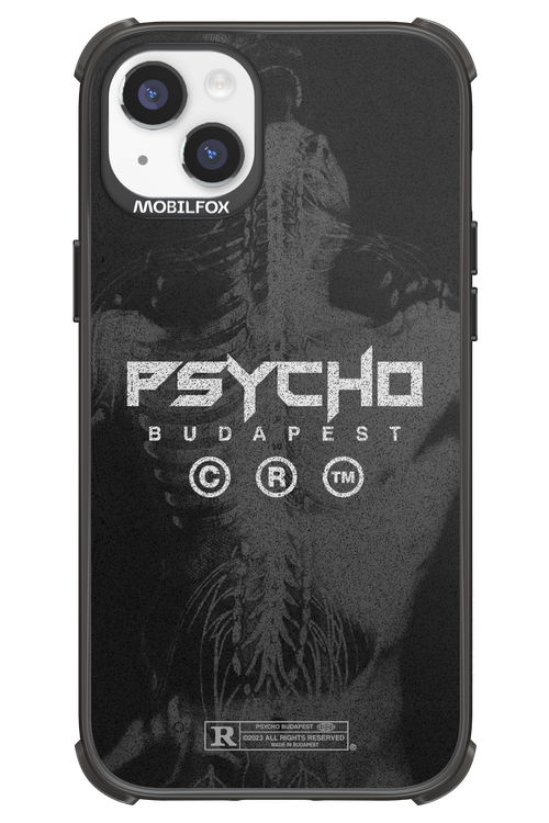 X-Ray - Apple iPhone 14 Plus