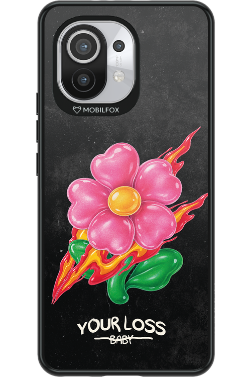 Your Loss 2.0 - Xiaomi Mi 11 5G