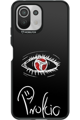 Profcio Eye - Xiaomi Mi 11 Lite (2021)