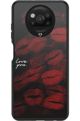 LOVE U BLACK 2.0 - Xiaomi Poco X3 NFC