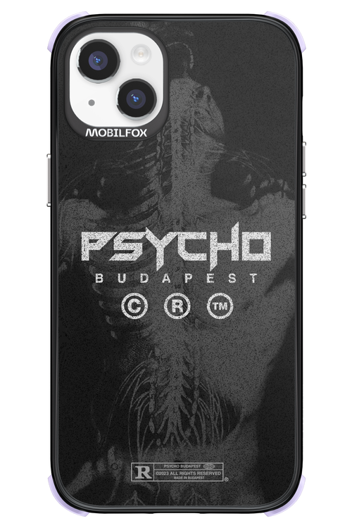 X-Ray - Apple iPhone 14 Plus